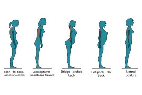 Body Posture Precision Massage Clinic
