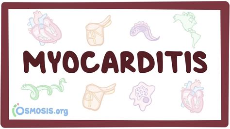 Myocarditis Video Anatomy Definition And Function Osmosis