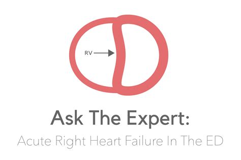 Ask The Expert Acute Right Ventricular Failure In The Ed — Nuem Blog