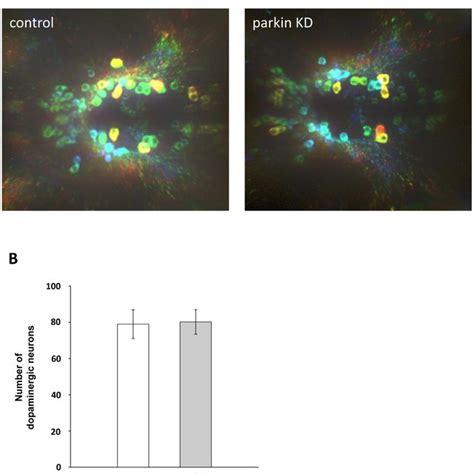 Dopamine Induces Aggregation Of Zebrafish Parkin Sh Sy5y Cells Grown