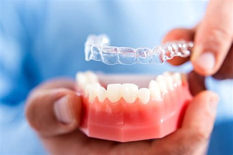 Tips For Invisalign Braces King Ritson Dental Oshawa