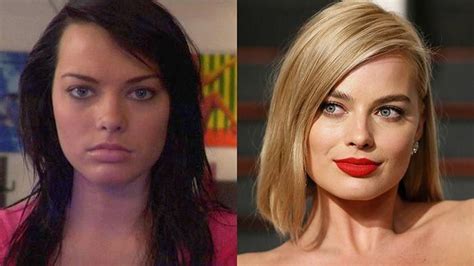 Margot Robbie Plastic Surgery Transformation Before And After Photos