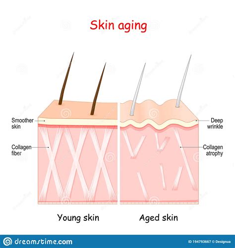Aging Process Comparison Of Young And Aged Skin Collagen Elastin And