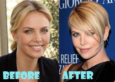 Charlize Theron Plastic Surgery Before And After Pictures Celebrities Then And Now Celebrities