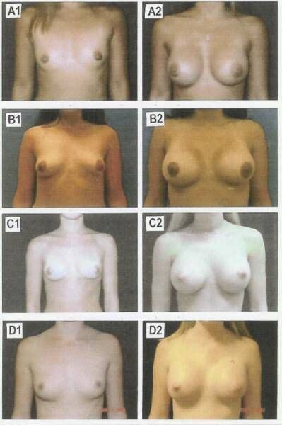 Breast Size Boob Chart Cumception