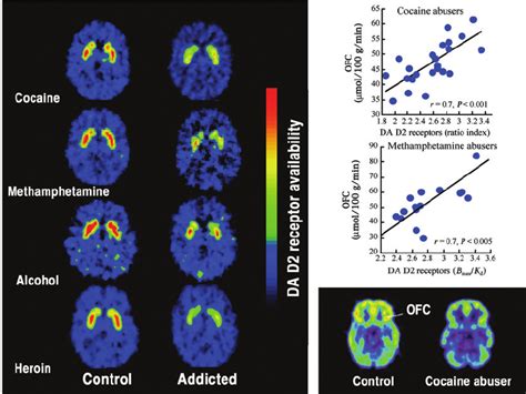 Relationship Between Dopamine Da D2 Receptors In The Brains Of Download Scientific Diagram