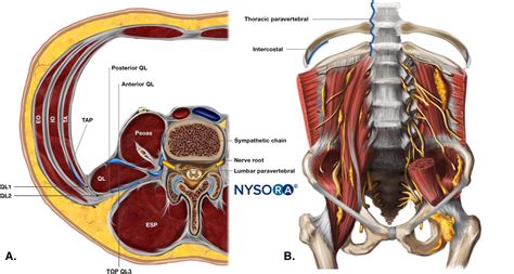 Quadratus lumborum block: an imaging study of three approaches