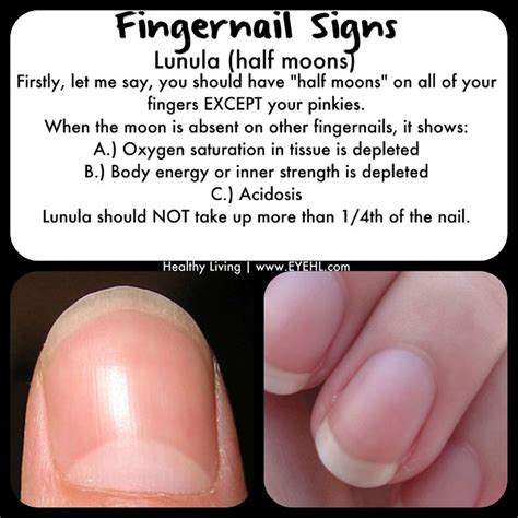 Check Your Fingernails Nail Health Health Info Body Health