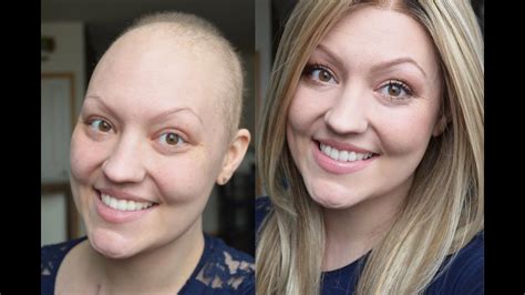 In addition, they can be groomed to enhance the aesthetics of the face. FULL MAKEUP TUTORIAL FOR CHEMO PATIENTS - "GO-TO" NEUTRAL ...