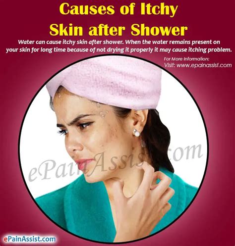 causes of itchy skin after shower remedies to get rid of it