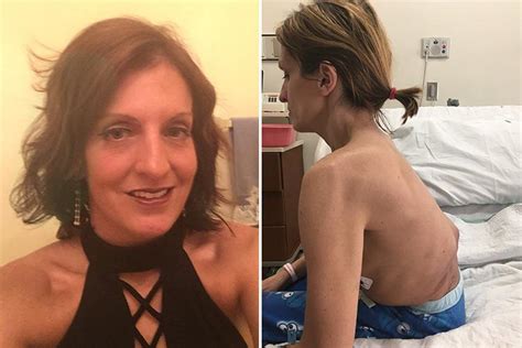 Mum Suffers Rare Painful Condition Which Left Her Looking Like A