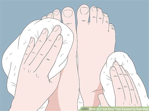 3 Ways To Treat Itchy Feet Caused By Diabetes Wikihow