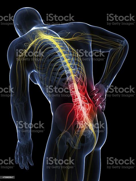 Xray Visualization Image Of Man With Acute Lower Back Pain Stock Photo