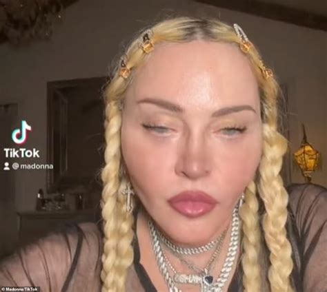 Madonna Fans Grow Concerned Over The Star S Unsettling Appearance