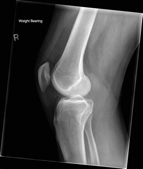 Normal Knee Image