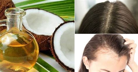 Find out how your hair can benefit from the moisturizing, detangling, and protective properties found in coconut oil!</p. DIY Coconut Oil And Honey Hair Mask | Recipe & Benefits ⋆ ...
