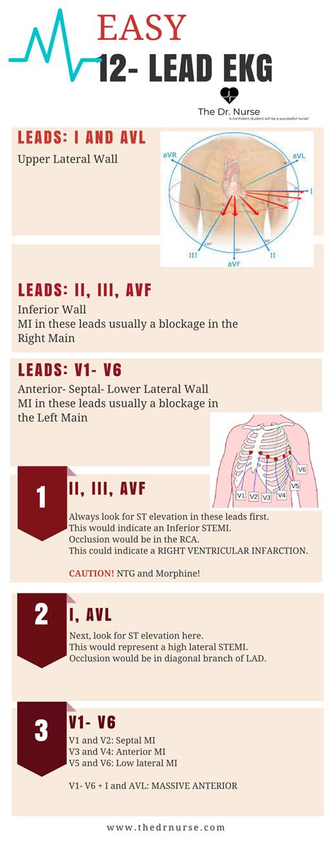 Use These Three Easy Steps To Learn 12 Lead Ekg Interpretation More