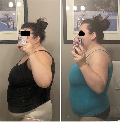 Ozempic Results Just Over Two Months Between Then And Now Down Lbs