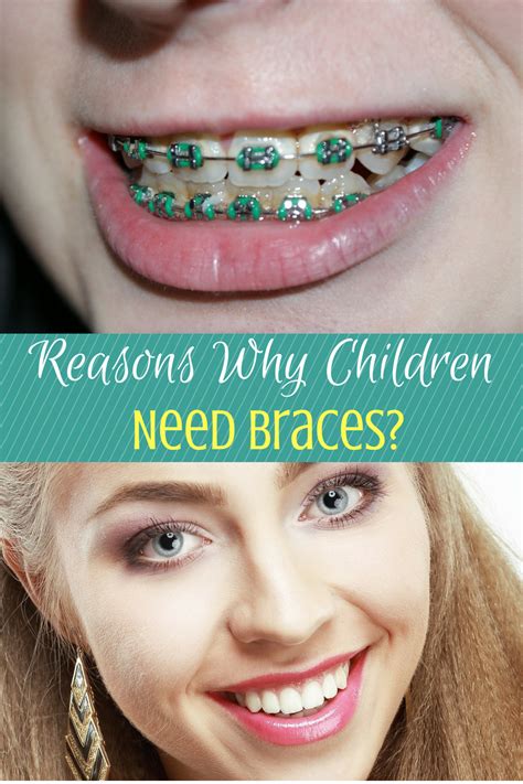 What To Expect If Your Child Needs Braces Gardner Quad Squad