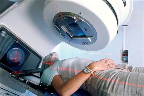 Radioterapia no Câncer de Colo de Útero Braquiterapia