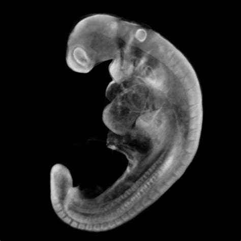 Human Embryo Atlas Human Fetal Atlas