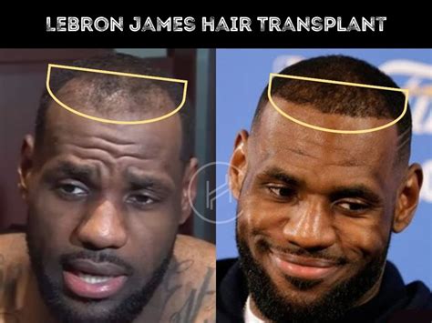 LeBron James Does Have Hair Installments Paul George And Jalen Green