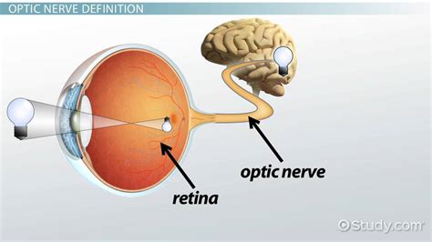 Optic Nerve Damage Overview Symptoms And Treatment Video And Lesson