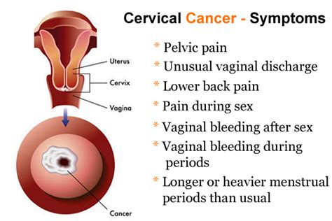 know everything about cervical cancer testing