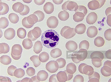 Neutrophil White Blood Cell Nucleus The Most Common Wbc