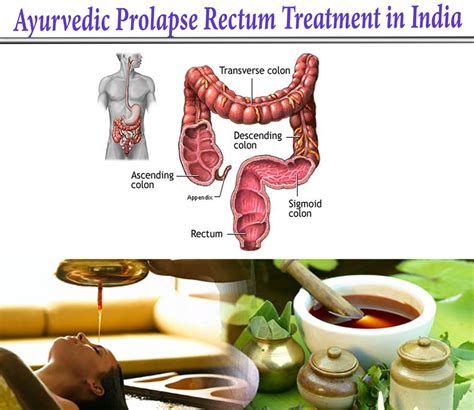 Get Familiar With Prolapse Rectum And Its C﻿auses