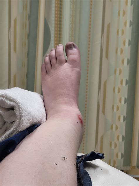 4 best u/cerisandromeda images on Pholder | Crested Gecko, Medical Gore