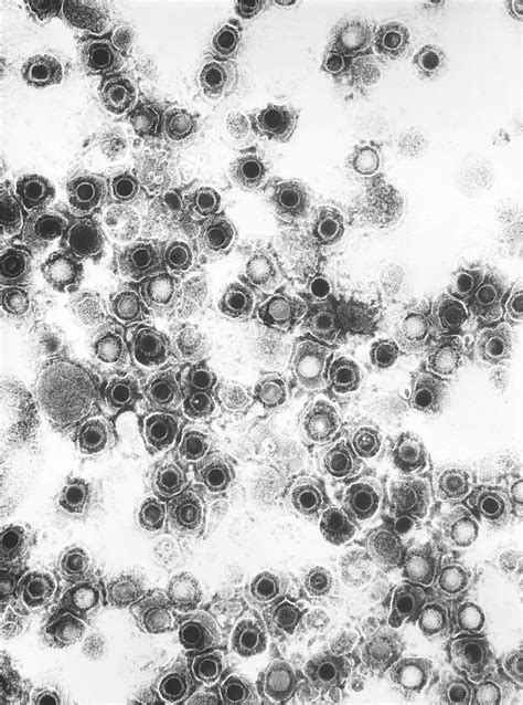 Electron Micrograph Of Coxsackie Virus Biology Of Human World Of Viruses