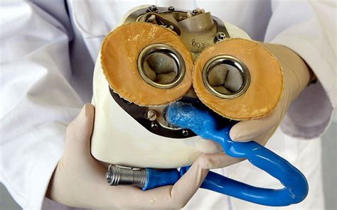 France Implants Its First Artificial Heart Telegraph