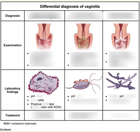 Differential Dx Of Vaginitis Diagram Quizlet