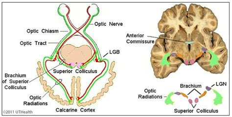 Neuroanatomy Online Lab 8 ƒ7 Visual System Gross Anatomy Of The Eye