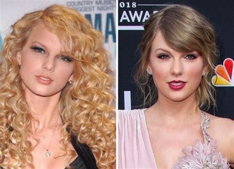 Taylor Swifts Plastic Surgery Has Taylor Swift Undergone Cosmetic