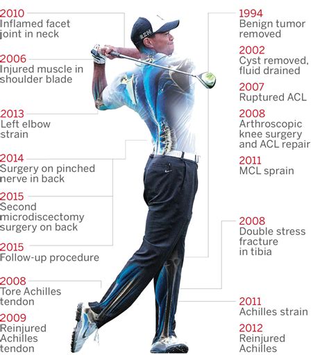 Tiger Woods Injury Timeline Abc News