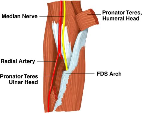 Unusual Compression Neuropathies Of The Forearm Part Ii Median Nerve