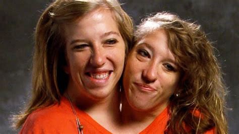 Abby And Brittany Hensel Conjoined Twins Where Are They Now Cupuno