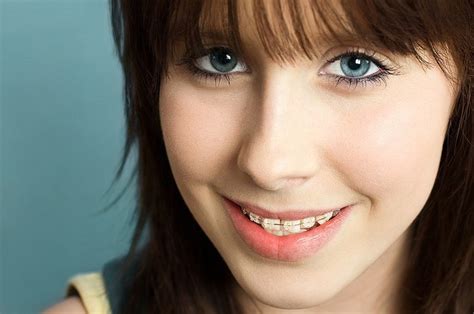 Preventing Cavities While Wearing Braces Langley Dental Practice