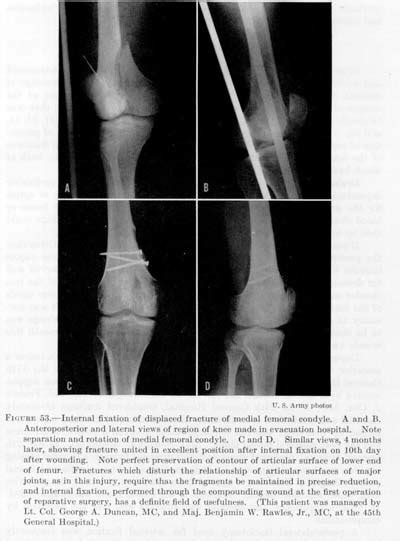 Office of Medical History - ORTHOPEDIC SURGERY in the ...