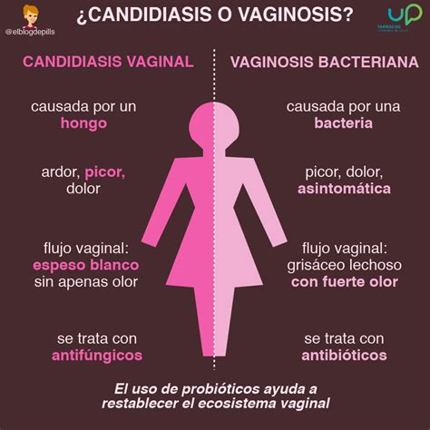 Infecciones Vaginales Candidiasis Y Vaginitis Sintomas Tratamiento