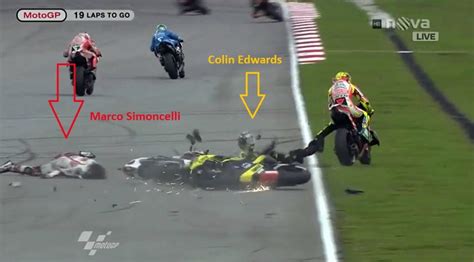 Simoncelli Was Killed Due To An Injury On The Chest Neck