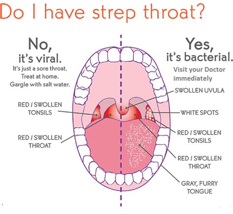 Sign In Throat Remedies Strep Throat Remedies Strep Throat 057