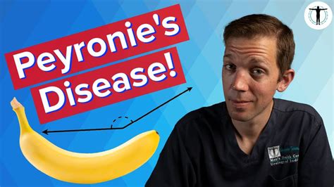 Does Your Penis Curve Treating Peyronies Disease Youtube