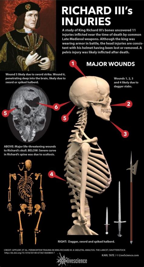 King Richard Iii Had Blond Hair And Sparkly Blue Eyes Dna Tests Reveal