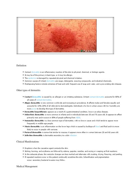 Contact Dermatitis Pdf Dermatitis Dermatology