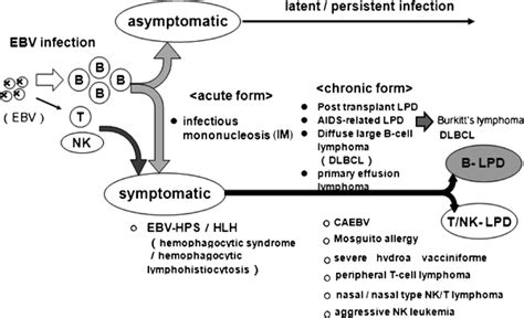 Current Diagnosis And Treatment Strategy For Chronic Active Epstein