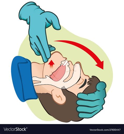 First Aid Person Opening Mouth Clearing Airway Vector Image