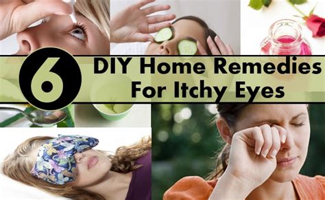 Causes and risk factors for itchy eyes. 6 DIY Home Remedies For Itchy Eyes | DIY Health Remedy